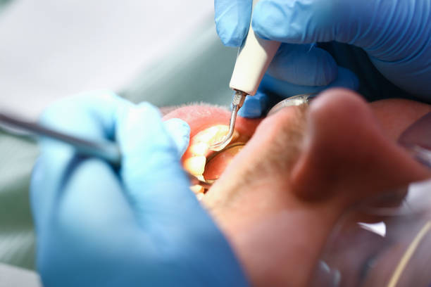 Best Emergency Gum Pain Relief  in Snellville, GA
